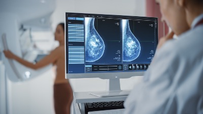 "Žene mesecima čekaju termin za mamografski pregled"