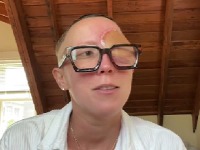 Ukazivalo na sinusnu infekciju, izgubila oko (VIDEO)