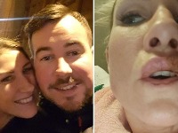 Htela duplu dozu filera: Usna EKSPLODIRALA 