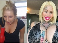 Devojka zavisna od estetskih operacija pokazala stare slike