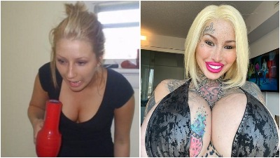 Devojka zavisna od estetskih operacija pokazala stare slike