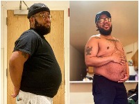 "Misle da je pivski stomak" OPET TRANS-TRUDNOĆA 