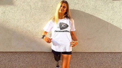Mariji potrebna nova proteza, akciju pokrenuo fudbaler koji je ostao bez noge