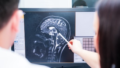 Nauka objasnila događanja u mozgu osobe koja vara