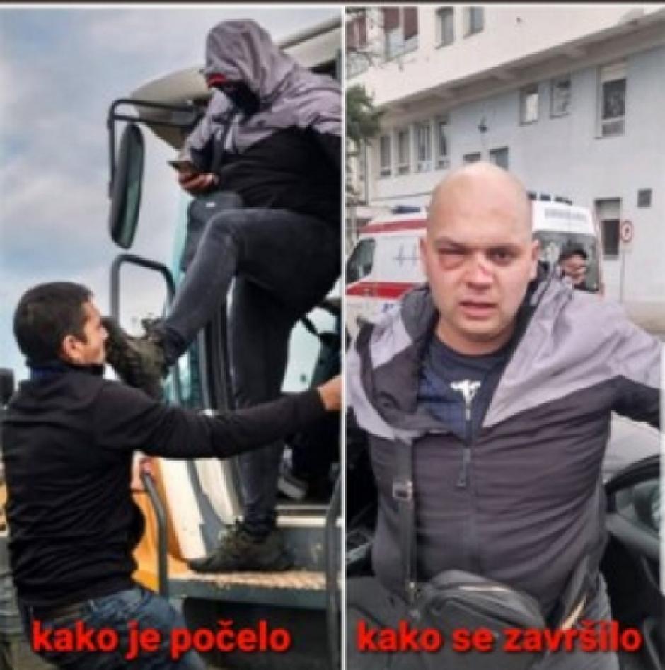 Vozač bagera u Šapcu pre i posle napada FOTO: Društvene mreže