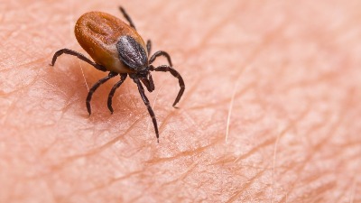 Hitno oglašavanje lekara: U Srbiji potvrđen prvi slučaj alergije na crveno meso izazvane ubodom opasnog parazita