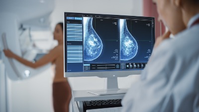 Zvala 170 puta da zakaže besplatni mamograf - bez uspeha