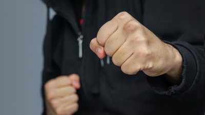 Nasilje u Surčinu: Muškarcu slomljene kosti lica
