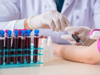 Šta jesti dan pre vađenja krvi? Mnogi prave OVE GREŠKE koje utiču na nalaz