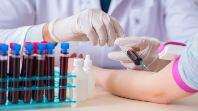 Šta jesti dan pre vađenja krvi? Mnogi prave OVE GREŠKE koje utiču na nalaz