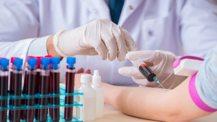 Šta jesti dan pre vađenja krvi? Mnogi prave OVE GREŠKE koje utiču na nalaz