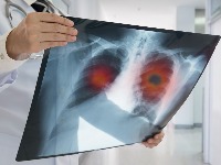 Domaća namirnica čisti PLUĆA kao METLOM: Pravo je blago, a potpuno je zaboravljena 