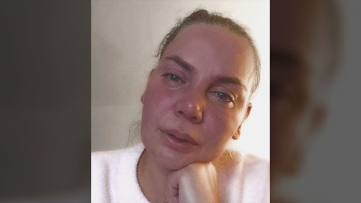 "Lako je osuđivati": Jelena Dokić o psihičkoj bolesti