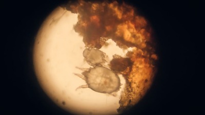 Škole i vrtići pod pretnjom: Nakon Umke, šuga se širi i u Grockoj