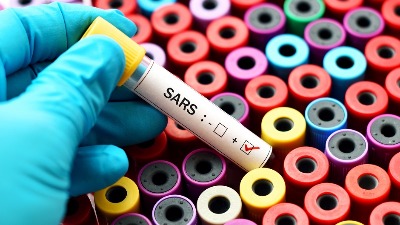 Umro doktor koji je razotkrio zataškavanje SARS-a