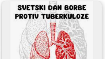 Svetski dan borbe protiv tuberkuloze - Lečenje posebnih kategorija bolesnika