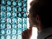 Neurolog otkriva da JEDNA NAVIKA može da održi mozak mladim decenijama 