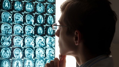 Neurolog otkriva da JEDNA NAVIKA može da održi mozak mladim decenijama 