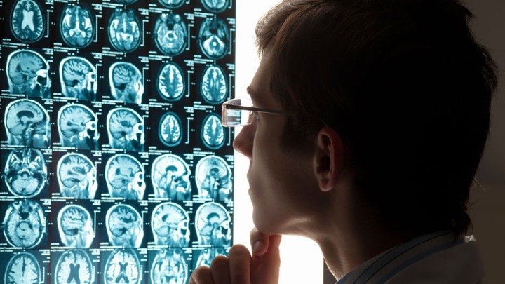 Neurolog otkriva da JEDNA NAVIKA može da održi mozak mladim decenijama 