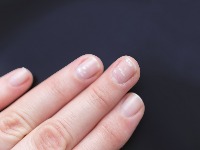 Primetili ste linije na noktima? Evo šta znače i kada su RAZLOG ZA BRIGU