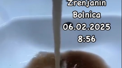 Crna kao BLATO: Pogledajte kako izgleda voda u zrenjaninskoj bolnici (VIDEO)