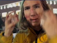 Student Vukašin Đinović povređen u sukobu s policijom: Nabio me je štitom u glavu, ničim izazvan