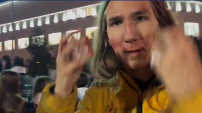 Student Vukašin Đinović povređen u sukobu s policijom: Nabio me je štitom u glavu, ničim izazvan