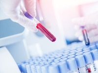 Novi test krvi mogao bi da predvidi bolesti i do 10 godina unapred