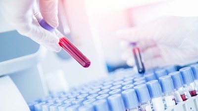 Novi test krvi mogao bi da predvidi bolesti i do 10 godina unapred