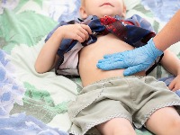 Zaraženo više od 400 mališana, 14 žarišta u Beogradu: Kako da prepoznate dečje gliste i kako se leče