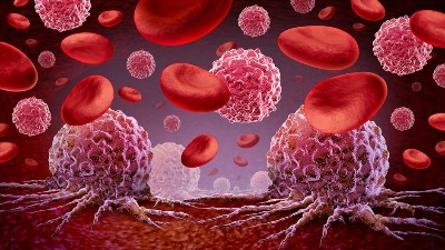 Novi način lečenja poništava neizlečivi rak krvi kod nekih pacijenata