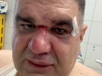 Saša Mirković iz bolnice na TikToku: Spremam se za operaciju, sad pitam tužioca...