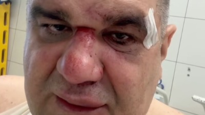 Saša Mirković iz bolnice na TikToku: Spremam se za operaciju, sad pitam tužioca...