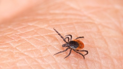 Kako ukloniti krpelja sa kože? Lekarka otkriva da je samo JEDAN BEZBEDAN NAČIN 