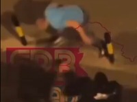 UZNEMIRUJUĆE: Slika mladića nakon što mu je Karlik Džons razbio glavu flašom