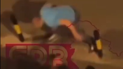 UZNEMIRUJUĆE: Slika mladića nakon što mu je Karlik Džons razbio glavu flašom