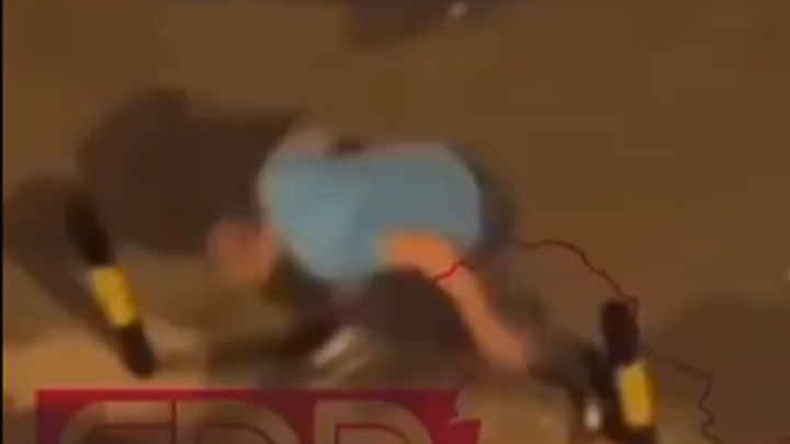 "Posekli su me po licu! Nisam provocirao, navijač sam Partizana": Oglasio se muškarac kome je Džons razbio flašu o glavu