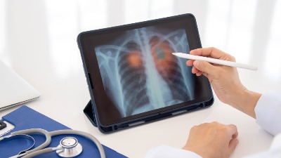 7 simptoma UPALE PLUĆA: Ako ih primetite ODMAH se JAVITE LEKARU 