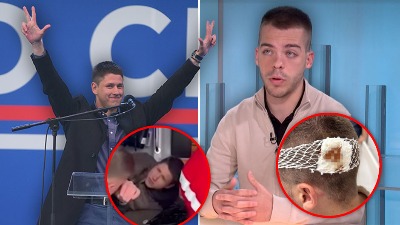 Loše izrežirana predstava režima: "Napad" na Ćacija kao odgovor na razbijenu glavu studenta Pravnog