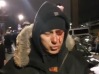 Tužilaštvo i MUP ćute o slučaju policajca Lazara Baćića povređenog ispred RTS-a