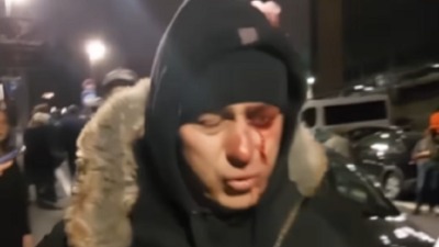 Tužilaštvo i MUP ćute o slučaju policajca Lazara Baćića povređenog ispred RTS-a