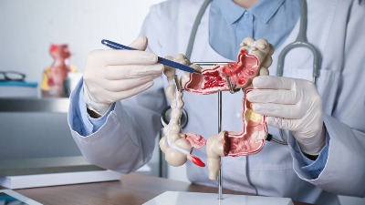 Ovu hranu jedu nutricionisti ako im se BLOKIRAJU CREVA