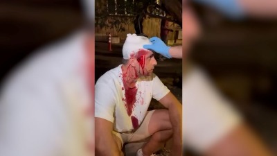 "Koalicija huligana, SNS i policije" Mitrović posle prebijanja: Policajci su videli kako krvav bežim od huligana i nisu reagovali