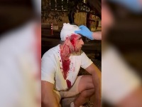 Mitrović: Prebijali su me SNS huligani - tužilaštvo štiti napadače