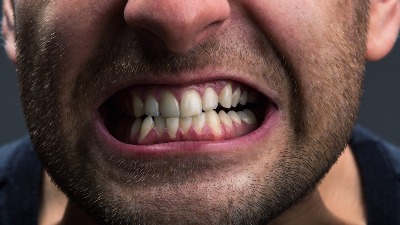 Zubar moli ljude da nikako ne izbeljuju zube na ovaj način: "Ostaćete bez zuba"