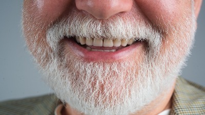 Prvi signal koji ukazuje da imate DEMENCIJU, a javlja se u USTIMA 