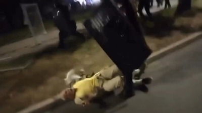 Stariji muškarac kojeg je žandarm gurnuo pokazao povrede: "Slomljen lakat, svaka koščica me boli" (VIDEO)