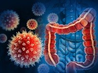 Uzorci tumora stari više od jednog veka mogli bi da otkriju uzroke povećanja broja raka creva kod mladih