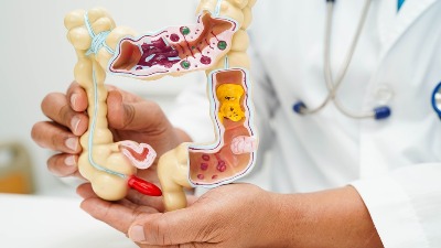 Pijani bez kapi alkohola: Ova retka bolest opija bez pića 