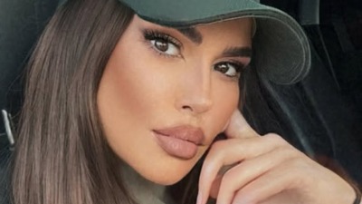 Dijana Diline imala nezgodu na skuteru u punoj blizini u Dubaiju: "Polomila sam vilicu, ne mogu da pričam" (FOTO)